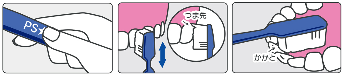 gpC[W